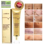 lanbena tcm,tcm scar and acne mark removal gel ointment,tcm scar and acne removal gel,tcm cream,lanbena scar removal review,tcm scar and acne mark removal gel,tcm scar removal gel,lanbena scar removal cream,tcm scar removal,lanbena acne scar removal cream,lanbena scar remover,tcm scar cream,tcm scar and acne mark,lanbena tcm scar and acne mark removal,tcm scar,tcm acne scar removal cream,tcm gel,lanbena tcm scar and acne mark removal gel ointment,tcm scar and acne mark removal,lanbena acne scar removal,scar and acne mark removal gel,tcm acne scar cream,lanbena scar removal stretch marks serum review,lanbena tcm gel ointment,tcm scar and acne removal gel ointment,lanbena scar removal cream review,tcm scar and acne removal gel fake,tcm scar removal cream,lanbena scar removal stretch marks cream review,tcm scar and acne removal,tcm scar and acne removal gel review,scar and acne mark removal gel ointment,lanbena scar cream,tcm scar and acne removal gel price,tcm scar and acne removal gel original,tcm scar removal in mercury drug,tcm scar and acne,tcm lanbena,tcm scar and acne marks removal gel,lan be na scar cream,tcm scar and acne mark removal gel ointment price,lanbena tcm scar and acne removal gel,tcm scar and acne mark removal gel ointment review,tcm scar and acne marks removal gel review,tcm scar and acne removal gel before and after,lanbena scar,lanbena acne scar removal serum review,lanbena scar and acne mark removal gel,lanbena ointment,manfaat lanbena tcm scar and acne mark removal gel ointment,tcm acne and scar removal gel,tcm scar and acne mark removal gel ointment original,tcm acne scar removal cream price,tcm acne scar removal,lanbena scar removal ingredients,tcm cream review,tcm scar gel,tcm cream price,tcm scar and acne removal cream,lanbena scar remover review,lanbena scar removal serum review,lanbena acne scar mark removal gel ointment,lanbena scar removal price,lanbena tcm scar,lanbena scar removal gel,tcm scar and acne removal gel ingredients,lanbena tcm scar removal gel,lanbena tcm scar and acne mark removal gel ointment ingredients,aliver tcm scar cream review,lanbena tcm scar and acne mark removal review,cara pakai tcm scar and acne mark removal gel ointment,tcm gel ointment,aliver tcm scar and acne mark removal gel ointment,tcm scar and acne removal ointment,lanbena scar removal gel review,manfaat tcm scar and acne mark removal gel ointment,tcm scar and acne mark removal gel review,tcm scar removal price,lanbena tcm review,lanbena tcm scar removal,tcm scar and acne mark removal gel ointment lanbena,original tcm scar cream,lanbena tcm scar and acne mark removal gel,tcm scar removal fake and original,lanbena tcm scar and acne mark removal gel ointment review,kegunaan tcm scar and acne mark removal gel ointment,tcm lanbena scar removal,lanbena tcm cream,lanbena acne scar,lanbena acne scar removal cream review,lanbena acne scar removal review,lanbena acne scar removal cream price,tcm scar and acne mark removal gel ointment prix,lanbena scar removal stretch marks serum watson,aliver tcm scar and acne removal gel,tcm scar and acne marks removal gel ointment,tcm scar and,lanbena gel ointment,tcm scar and acne mark removal ointment,lanbena tcm scar and acne mark removal gel review,lanbena acne gel review,lanbena tcm original,tcm scar and acne mark removal gel price,lanbena scar removal original,lanbena tcm website,lanbena scar and acne removal gel,tcm scar and acne mark removal gel ointment avis,lanbena tcm watson,tcm scar and acne removal gel lanbena,tcm scar acne mark removal gel,tcm scar removal gel ingredients,acne scar removal cream lanbena,tcm scar removal review,lanbena scar and acne mark removal gel ointment,lan be na scar gel,scar acne mark removing gel,lanbena tcm scar review,tcm gel review,tcm scar and acne mark removal review,harga tcm scar and acne mark removal gel ointment,aliver tcm scar removal gel,lanbena gel ointment review,tcm scar and mark removal gel ointment,tcm scar cream review,tcm acne mark removal gel,lanbena scar cream review,review lanbena scar,tcm lanbena scar eraser review,tcm acne scar removal gel,tcm scar removal cream review,tcm scar and acne mark removal gel ointment ingredients,scar & acne mark removal gel ointment,lanbena removal gel,tcm lanbena review,lanbena scar gel review,lanbena tcm gel ointment review,review lanbena tcm scar,tcm gel original,tcm scar removal gel ointment,lanbena tcm acne scar removal cream,lanbena tcm serum,tcm scar removal gel price,lanbena scar removal ointment,tcm scar gel review,review tcm scar and acne mark removal gel ointment,tcm acne scar,tcm removal gel,tcm scar and removal gel ointment,tcm acne and scar removal gel review,tcm scar and acne mark removal gel ointment deutsch,lan be na tcm scar and acne mark,lanbena scar serum review,tcm scar cream original,tcm acne mark removal gel ointment,lanbena acne scar remover,tcm lanbena cream,lanbena scar review,cara menggunakan tcm scar and acne mark removal gel ointment,fungsi tcm scar and acne mark removal gel ointment,lan be na cream,tcm acne scar cream review,tcm cream for scars,tcm lanbena original,lanbena tcm price,lanbena scar ointment,lanbena tcm scar remover,review lanbena acne scar,lanbena tcm stretch marks,tcm scar removal original